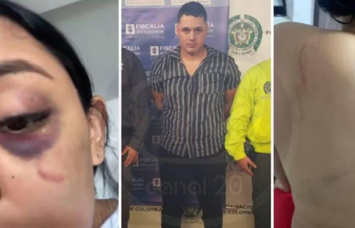 Bucaramanga : Un homme arrêté pour avoir attaqué son ex-compagne avec des ciseaux